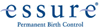 essure Sterilization
